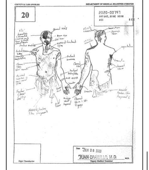 gigi autopsy sketch|File : Gianna Bryants autopsy report (2020).pdf